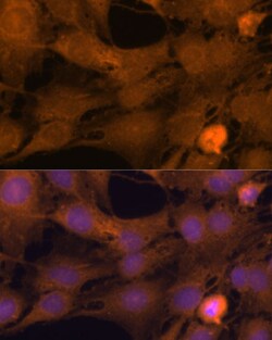 Invitrogen ZC3H7A Polyclonal Antibody 100 &mu;L; Unconjugated:Antibodies,
