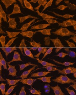 Invitrogen ZC3H7A Polyclonal Antibody 100 &mu;L; Unconjugated:Antibodies,