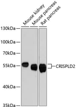 Invitrogen CRISPLD2 Polyclonal Antibody 100 &mu;L; Unconjugated:Antibodies,