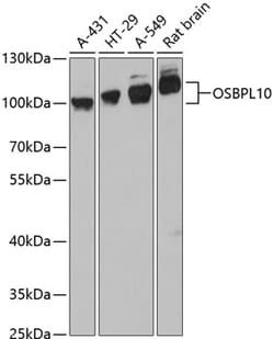 Invitrogen OSBPL10 Polyclonal Antibody 100 &mu;L; Unconjugated:Antibodies,