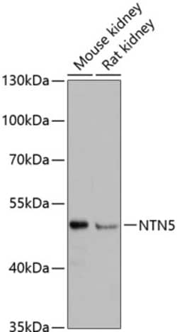 Invitrogen NTN5 Polyclonal Antibody 100 &mu;L; Unconjugated:Antibodies,