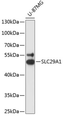 ENT1 Polyclonal Antibody:Anticorps, Polyclonal