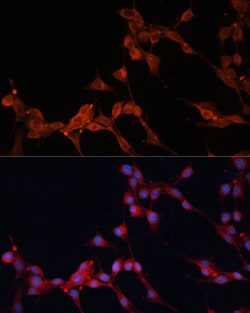 Invitrogen SLC25A38 Polyclonal Antibody 100 &mu;L; Unconjugated:Antibodies,
