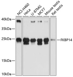 Invitrogen FKBP14 Polyclonal Antibody 100 &mu;L | Buy Online | Invitrogen&trade; | Fisher Scientific