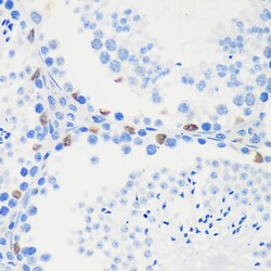 Invitrogen LARP2 Polyclonal Antibody 100 &mu;L; Unconjugated:Antibodies,
