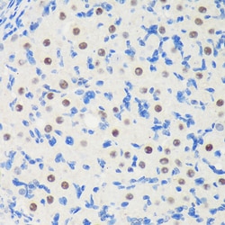 Invitrogen LARP2 Polyclonal Antibody 100 &mu;L; Unconjugated:Antibodies,