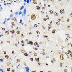 Invitrogen LARP2 Polyclonal Antibody 100 &mu;L; Unconjugated:Antibodies,