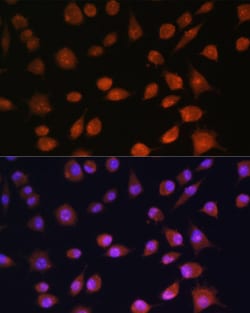 Invitrogen AROS Polyclonal Antibody 100 &mu;L; Unconjugated:Antibodies,