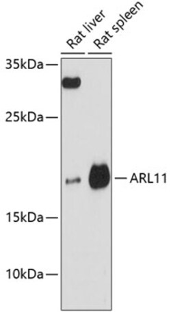 Invitrogen ARL11 Polyclonal Antibody 100 &mu;L; Unconjugated:Antibodies,