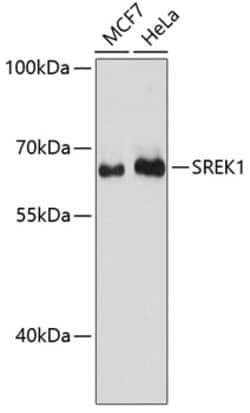 Invitrogen SFRS12 Polyclonal Antibody 100 &mu;L; Unconjugated:Antibodies,