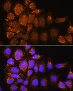 Invitrogen SYNE3 Polyclonal Antibody 100 &mu;L; Unconjugated:Antibodies,
