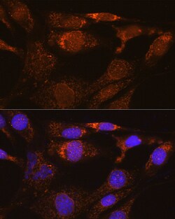 Invitrogen SYNE3 Polyclonal Antibody 100 &mu;L; Unconjugated:Antibodies,