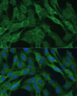 Invitrogen IDH1 Polyclonal Antibody 100 &mu;L; Unconjugated:Antibodies,