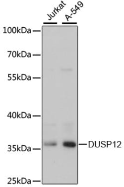 Invitrogen DUSP12 Polyclonal Antibody 100 &mu;L; Unconjugated:Antibodies,
