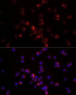 Invitrogen CXCL12 Polyclonal Antibody 100 &mu;L; Unconjugated:Antibodies,