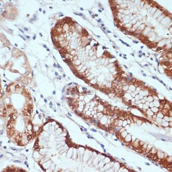 Invitrogen CXCL12 Polyclonal Antibody 100 &mu;L; Unconjugated:Antibodies,