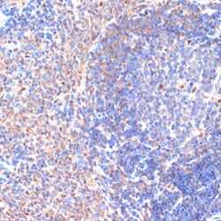 Invitrogen CXCL12 Polyclonal Antibody 100 &mu;L; Unconjugated:Antibodies,