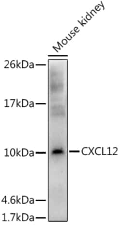 Invitrogen CXCL12 Polyclonal Antibody 100 &mu;L; Unconjugated:Antibodies,