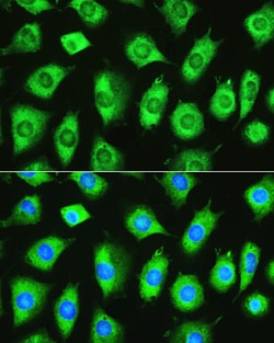 Invitrogen YTHDF1 Polyclonal Antibody 100 &mu;L; Unconjugated:Antibodies,