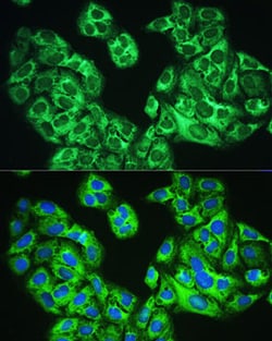 Invitrogen YTHDF1 Polyclonal Antibody 100 &mu;L; Unconjugated:Antibodies,