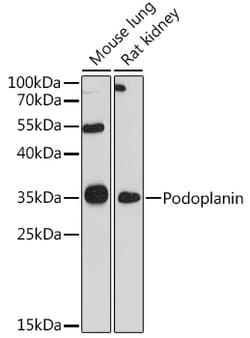 Invitrogen Podoplanin Polyclonal Antibody 100 &mu;L; Unconjugated:Antibodies,