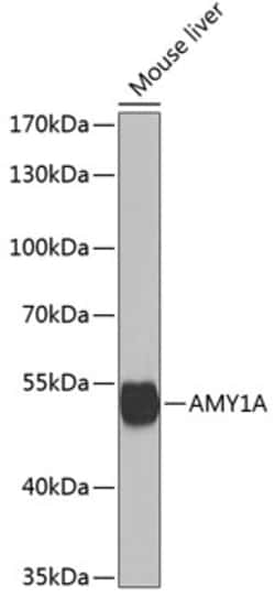Invitrogen alpha Amylase 1 Polyclonal Antibody 100 &mu;L; Unconjugated:Antibodies,