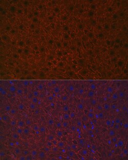 Invitrogen ASGR1 Polyclonal Antibody 100 &mu;L; Unconjugated:Antibodies,