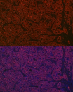 Invitrogen ASGR1 Polyclonal Antibody 100 &mu;L; Unconjugated:Antibodies,