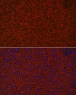Invitrogen ASGR1 Polyclonal Antibody 100 &mu;L; Unconjugated:Antibodies,