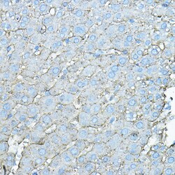 Invitrogen ASGR1 Polyclonal Antibody 100 &mu;L; Unconjugated:Antibodies,