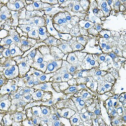 Invitrogen ASGR1 Polyclonal Antibody 100 &mu;L; Unconjugated:Antibodies,