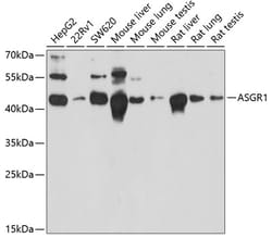 Invitrogen ASGR1 Polyclonal Antibody 100 &mu;L; Unconjugated:Antibodies,
