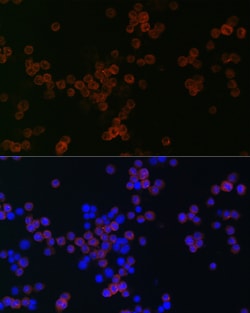 Invitrogen CD68 Polyclonal Antibody 100 &mu;L; Unconjugated:Antibodies,