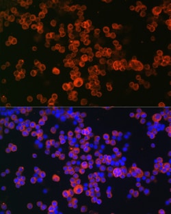 Invitrogen CD68 Polyclonal Antibody 100 &mu;L; Unconjugated:Antibodies,