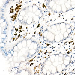 Invitrogen CD68 Polyclonal Antibody 100 &mu;L; Unconjugated:Antibodies,