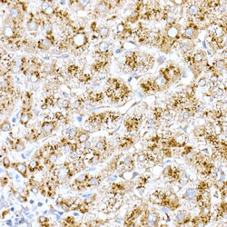 Invitrogen Cathepsin D Polyclonal Antibody 100 &mu;L; Unconjugated:Antibodies,
