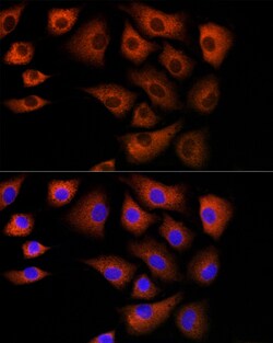 Invitrogen DBI Polyclonal Antibody 100 &mu;L; Unconjugated:Antibodies,