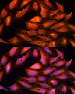 Invitrogen DBI Polyclonal Antibody 100 &mu;L; Unconjugated:Antibodies,