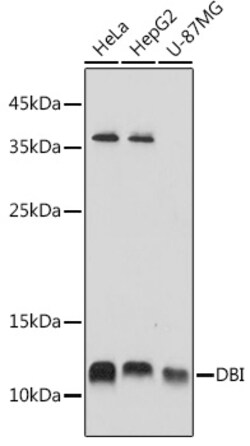 Invitrogen DBI Polyclonal Antibody 100 &mu;L; Unconjugated:Antibodies,