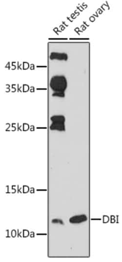Invitrogen DBI Polyclonal Antibody 100 &mu;L; Unconjugated:Antibodies,