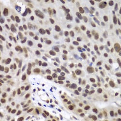 Invitrogen DDX5 Polyclonal Antibody 100 &mu;L; Unconjugated:Antibodies