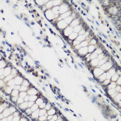 Invitrogen DHODH Polyclonal Antibody 100 &mu;L; Unconjugated:Antibodies,