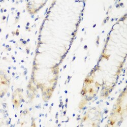 Invitrogen DHODH Polyclonal Antibody 100 &mu;L; Unconjugated:Antibodies,