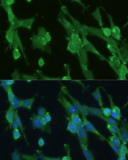 Invitrogen GPI Polyclonal Antibody 100 &mu;L; Unconjugated:Antibodies,