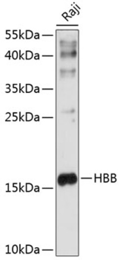 Invitrogen HBB Polyclonal Antibody 100 &mu;L | Buy Online | Invitrogen&trade; | Fisher Scientific