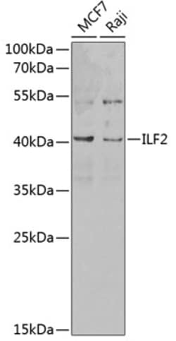 Invitrogen ILF2 Polyclonal Antibody 100 &mu;L; Unconjugated:Antibodies,