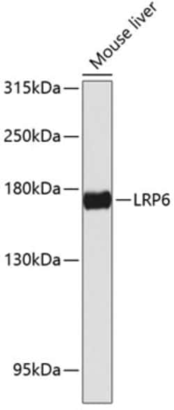 Invitrogen LRP6 Polyclonal Antibody 100 &mu;L; Unconjugated:Antibodies,