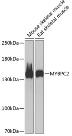 Invitrogen MYBPC2 Polyclonal Antibody 100 &mu;L; Unconjugated:Antibodies,