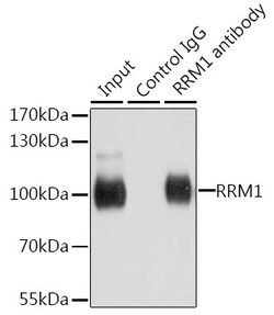 Invitrogen RRM1 Polyclonal Antibody 100 &mu;L; Unconjugated:Antibodies,