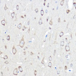 Invitrogen Seryl-tRNA synthetase Polyclonal Antibody 100 &mu;L; Unconjugated:Antibodies,